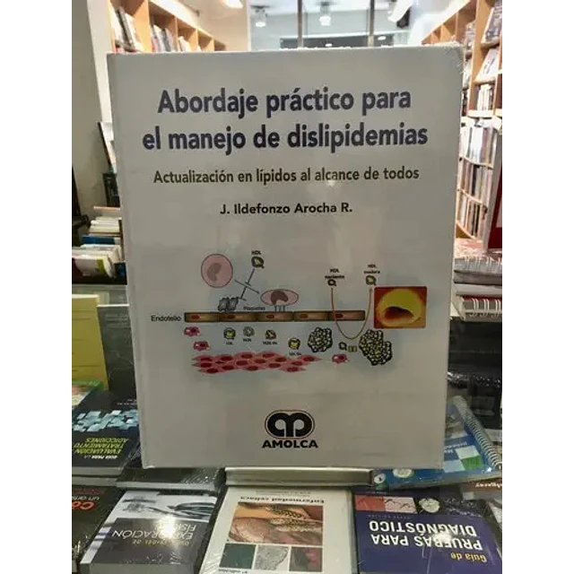 Abordaje práctico para el manejo de dislipidemias