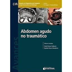 Abdomen agudo no traumático