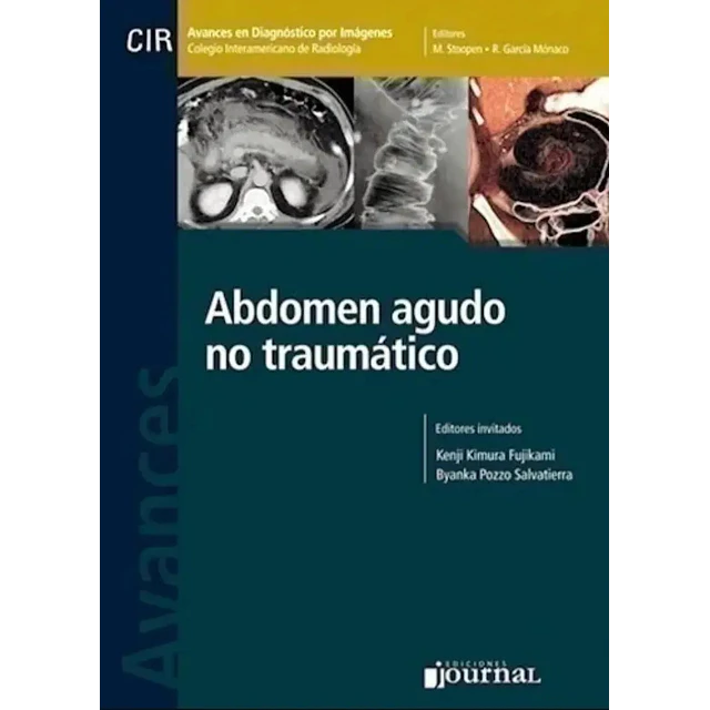 Abdomen agudo no traumático