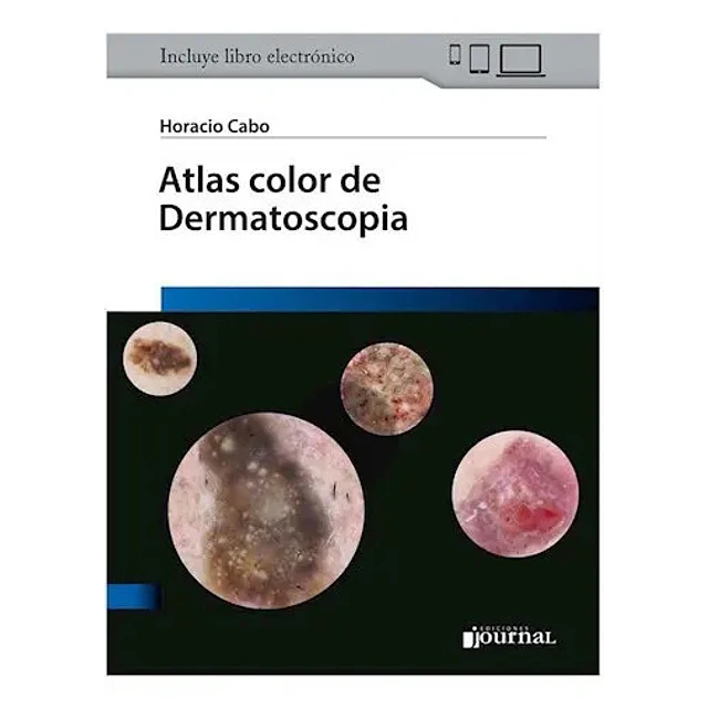 Atlas color de Dermatoscopia