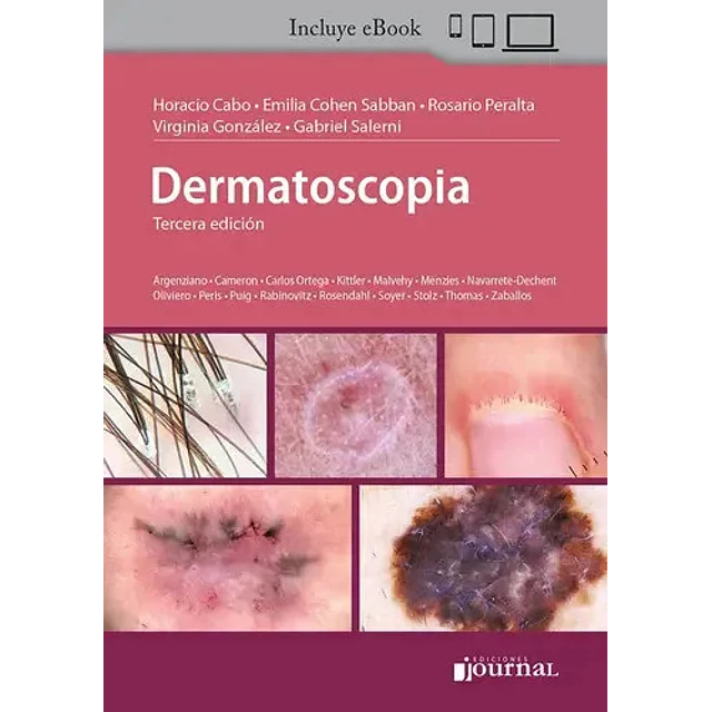 Dermatoscopia