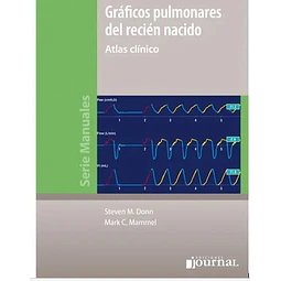 Gráficos pulmonares del recién nacido