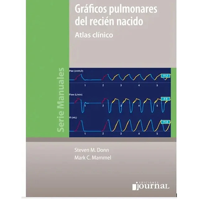 Gráficos pulmonares del recién nacido