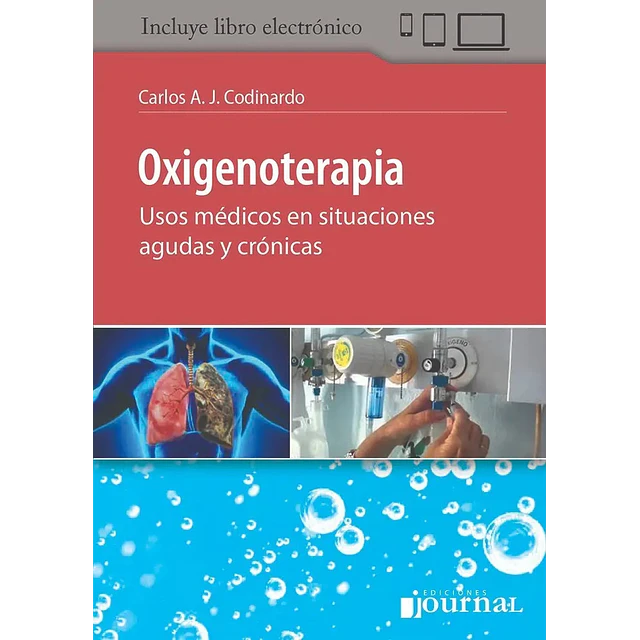 Oxigenoterapia