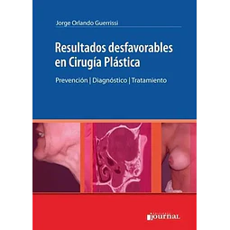 Resultados Desfavorables en Cirugía Plástica