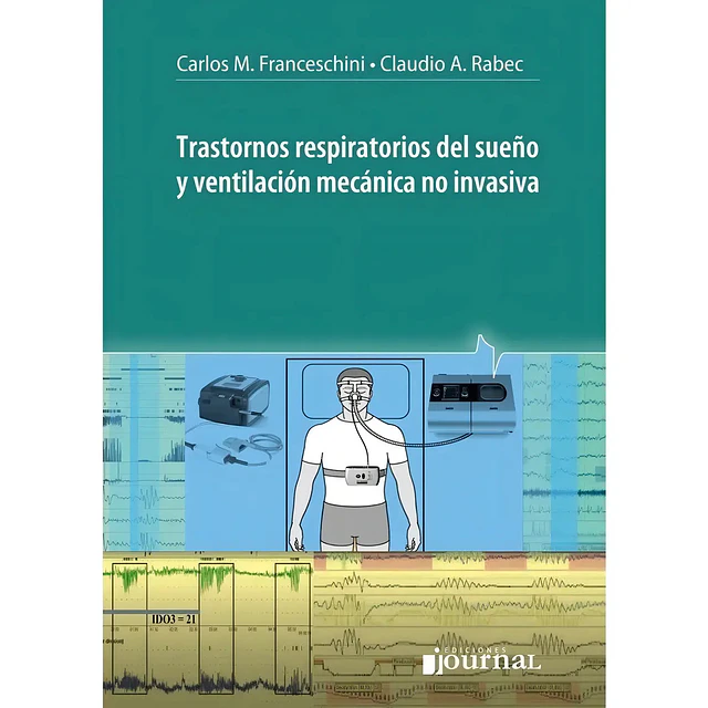 Trastornos Respiratorios del Sueño y Ventilación Mecánica No Invasiva
