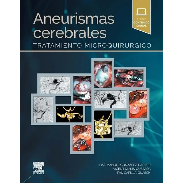 Aneurismas cerebrales. Tratamiento microquirúrgico