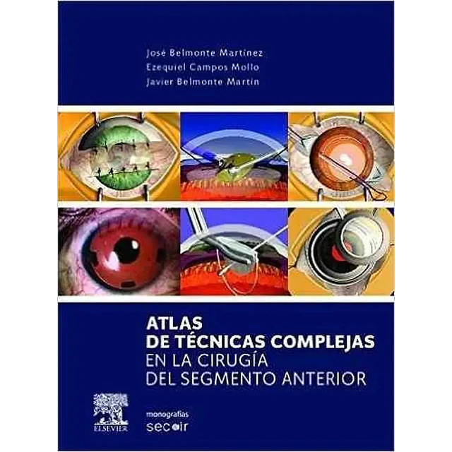 Atlas de Técnicas Complejas en la Cirugía del Segmento Anterior