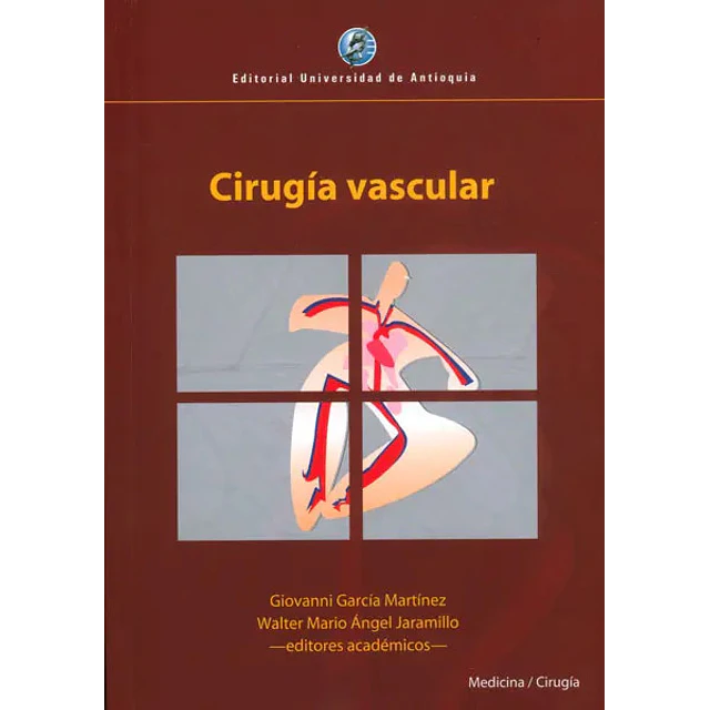 Cirugía Vascular