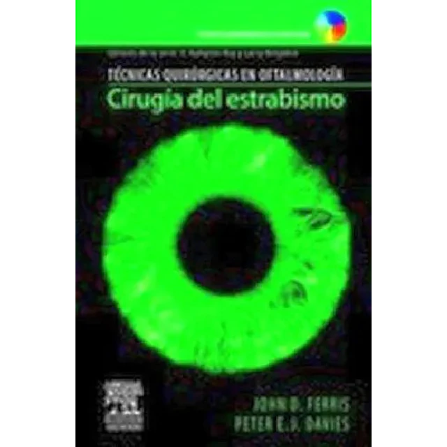 Cirugía del estrabismo