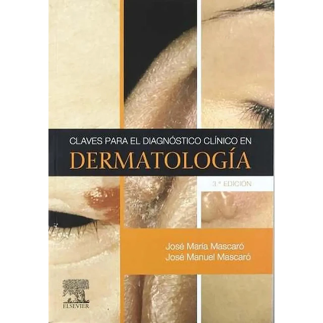 Claves para el diagnostico clinico en Dermatologia