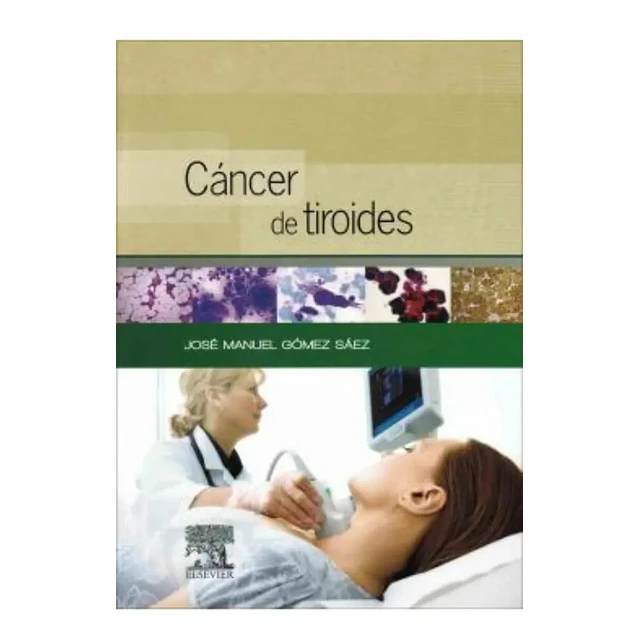 Cáncer de Tiroides