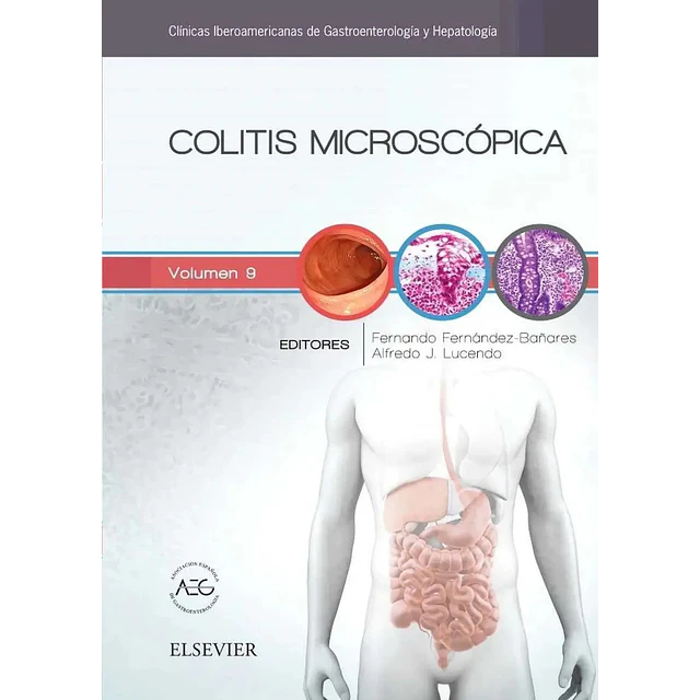 Colitis Microscópica volumen 9