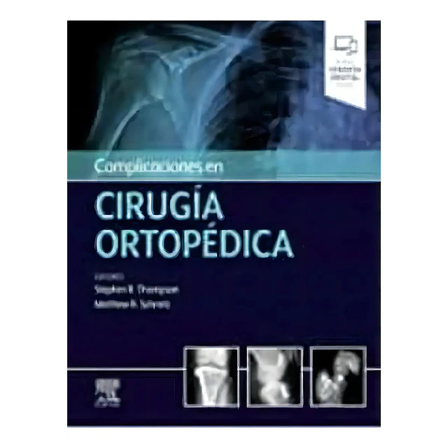 Complicaciones en cirugía ortopédica