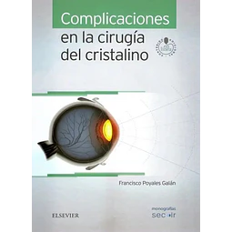 Complicaciones en la Cirugía del Cristalino