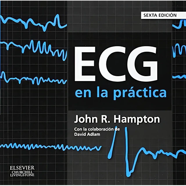 ECG en la práctica