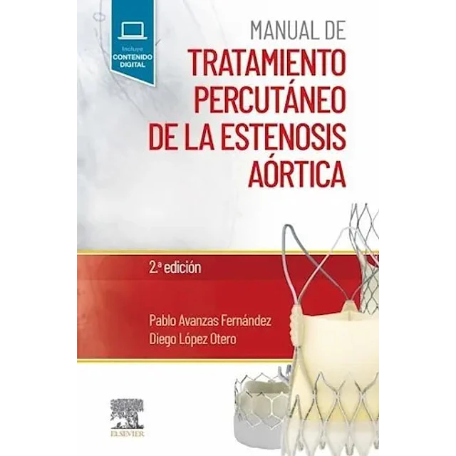 Manual de Tratamiento Percutáneo de la Estenosis Aórtica