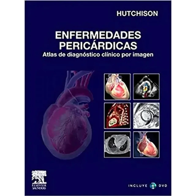 Enfermedades pericardicas con DVD