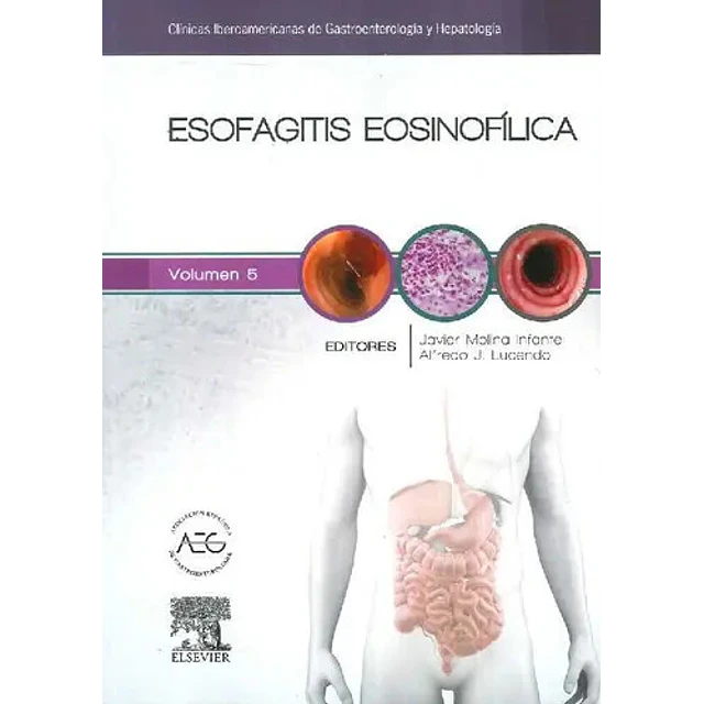 Esofagitis Eosinofílica