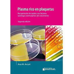 Plasma rico en plaquetas