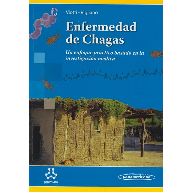 Enfermedad de Chagas