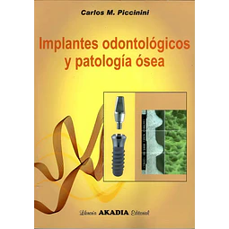 Implantes Odontológicos y Patología Ósea