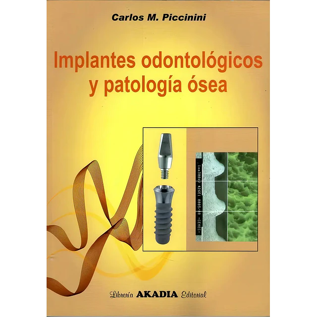 Implantes Odontológicos y Patología Ósea