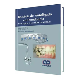 Brackets de Autoligado en Ortodoncia
