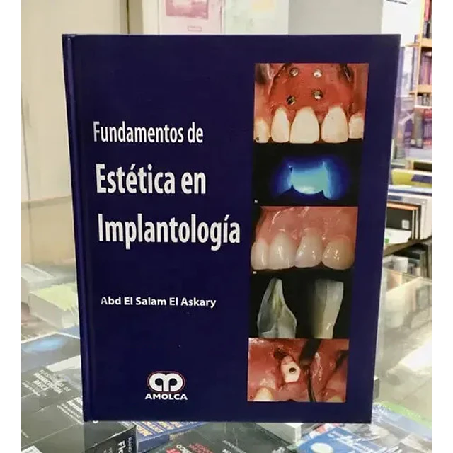 Fundamentos de Estética en Implantología