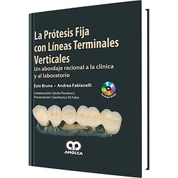 La Prótesis Fija con Líneas Terminales Verticales