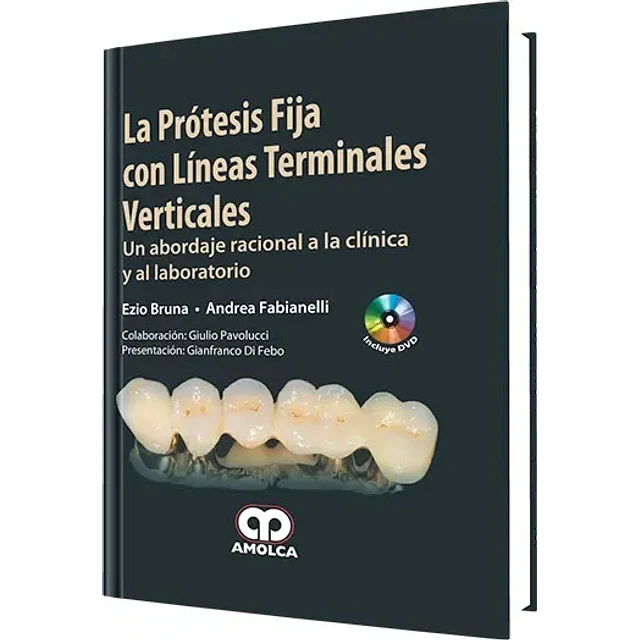 La Prótesis Fija con Líneas Terminales Verticales