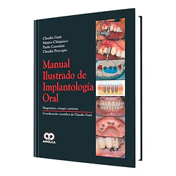 Manual Ilustrado de Implantología Oral