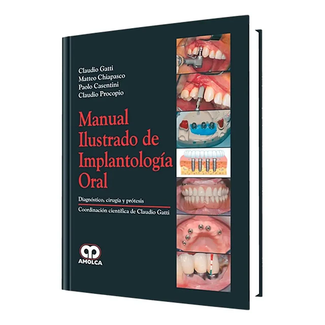 Manual Ilustrado de Implantología Oral