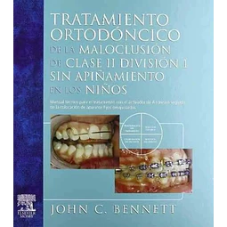 Tratamiento Ortodoncico de la maloclusión de clase II division 1 sin apiñamiento en los niños