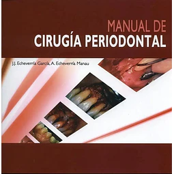Manual de Cirugia Periodontal