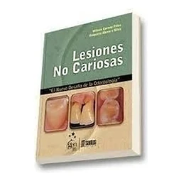 Lesiones no cariosas