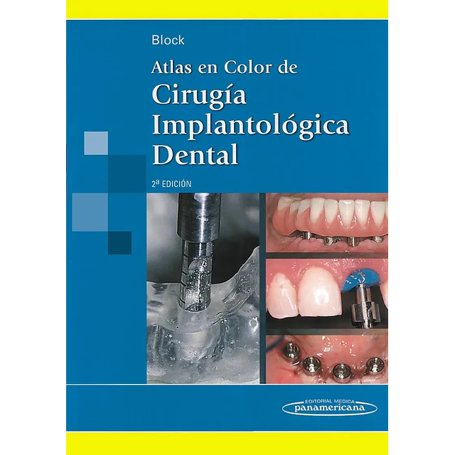 Atlas en color de Cirugía Implantológica Dental