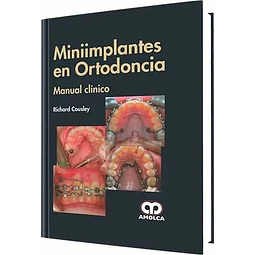 Miniimplantes en Ortodoncia