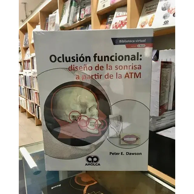 Oclusión funcional: diseño de la sonrisa a partir de la ATM