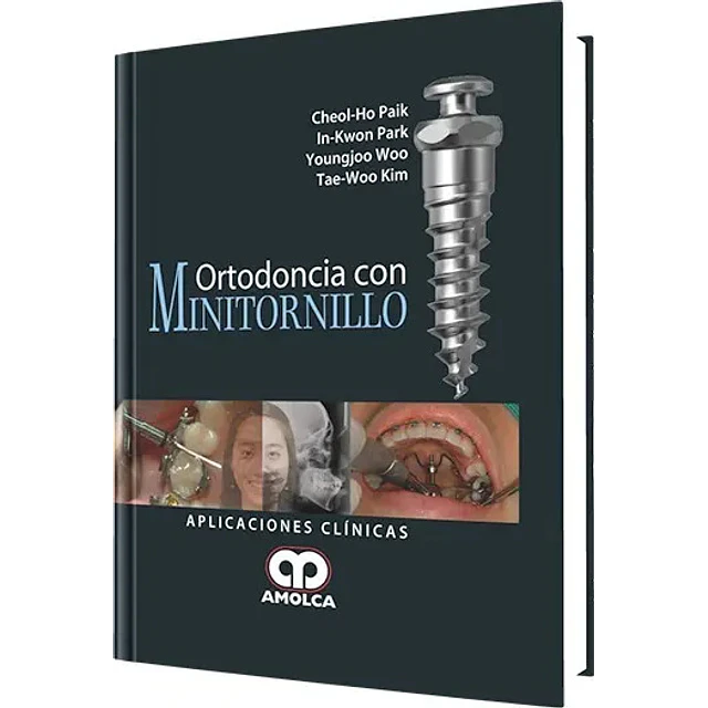 Ortodoncia con Minitornillo