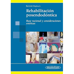 Rehabilitación posendodóntica