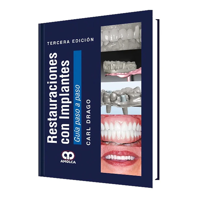 Restauraciones con Implantes