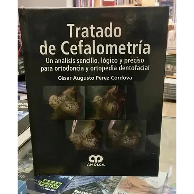 Tratado de Cefalometría