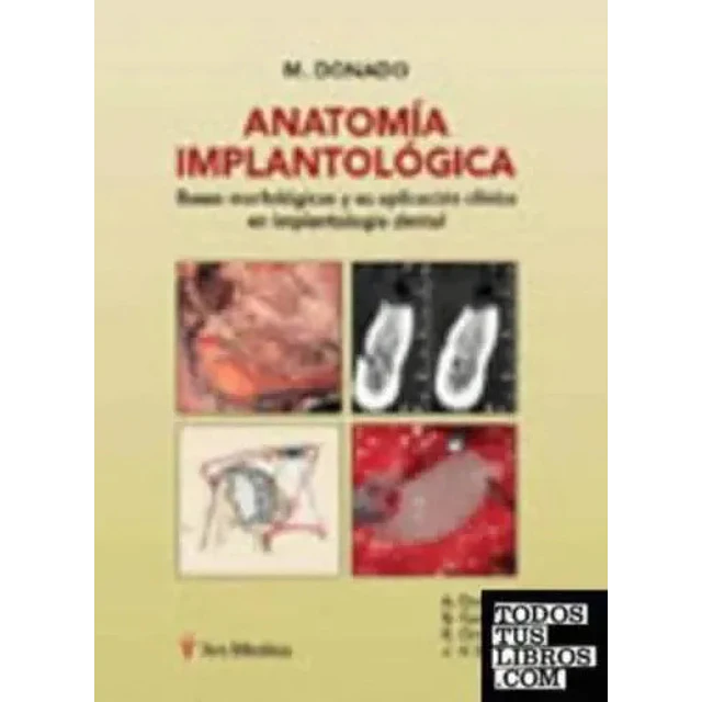 Anatomía Implantológica