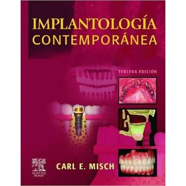 Misch Implantología Contemporánea