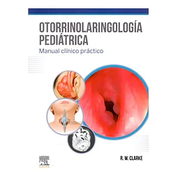 Otorrinolaringología Pediátrica