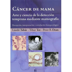 Cáncer de Mama