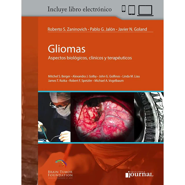 Gliomas. Aspectos biológicos, clínicos y terapéuticos.
