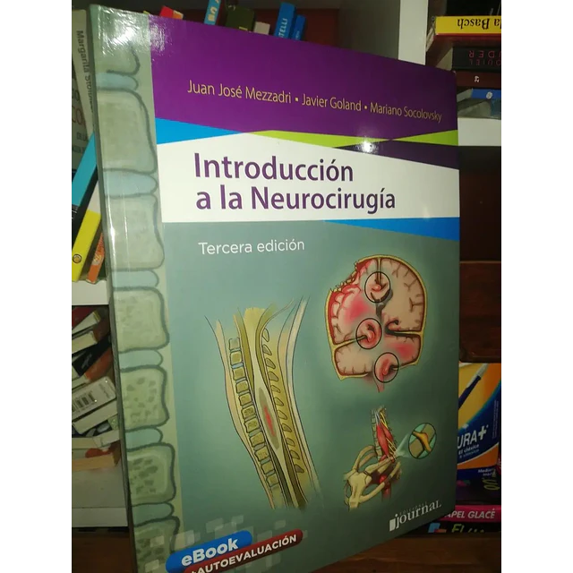 Introducción a la Neurocirugía