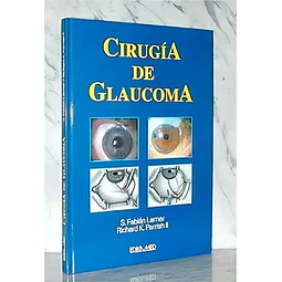 Cirugia de glaucoma